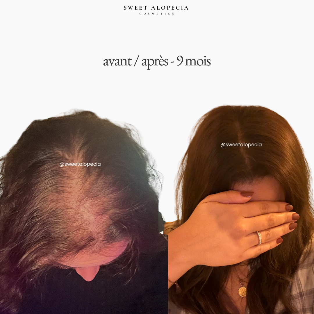 Le Duo Synergie - 2 mois de cure