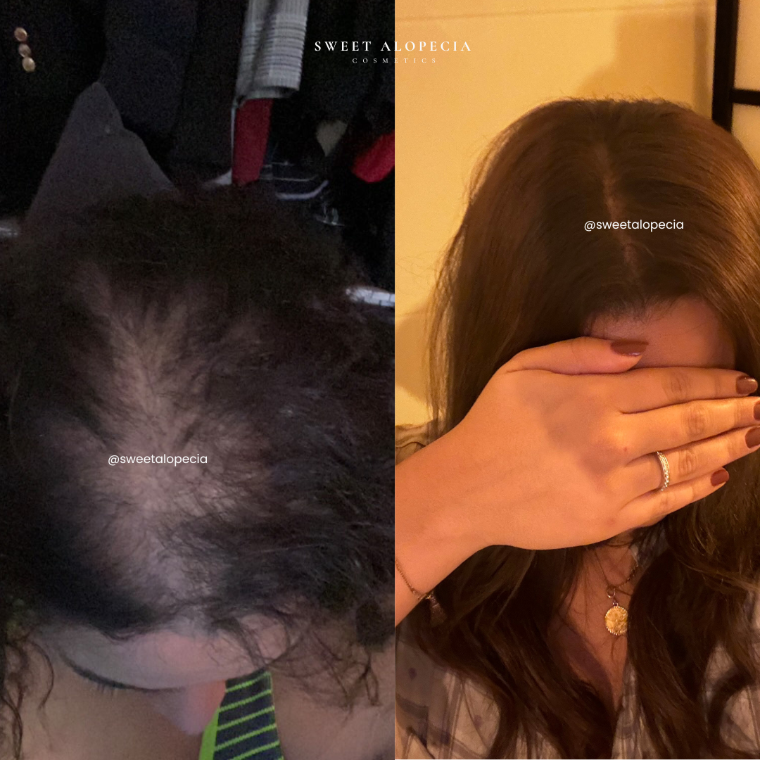 Le Duo Synergie - 4 mois de cure