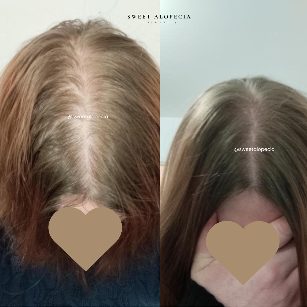 Le Duo Synergie - 4 mois de cure