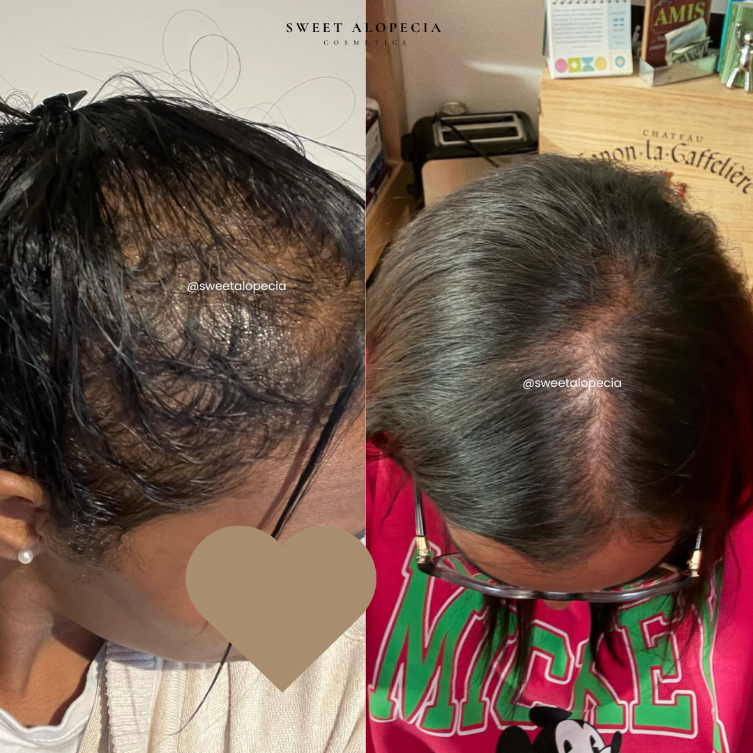 Le Duo Synergie - 4 mois de cure