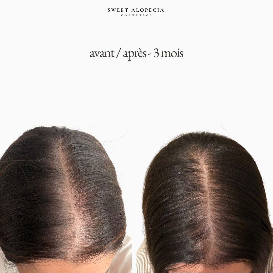 Le Duo Synergie - 2 mois de cure