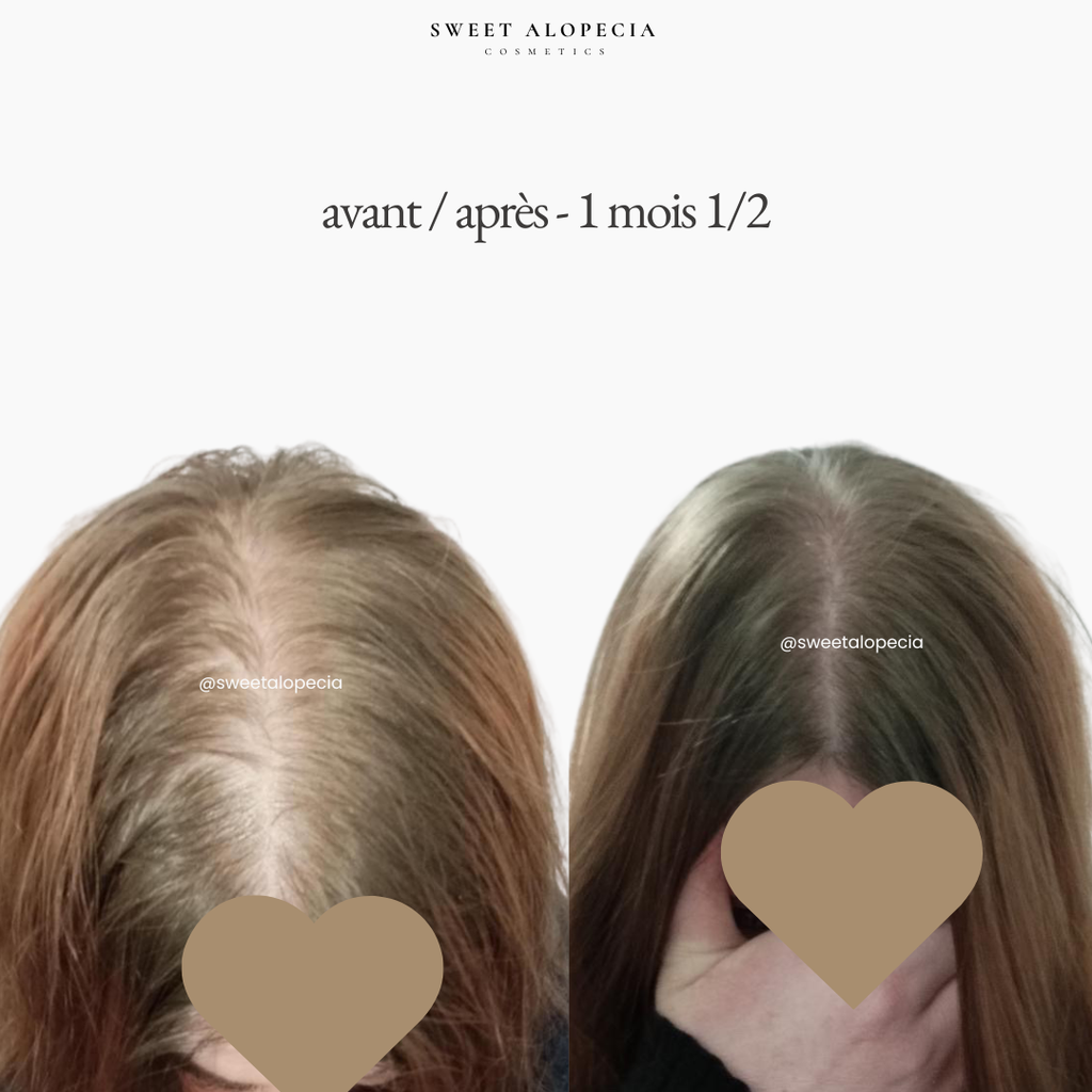 Le Duo Synergie - 2 mois de cure