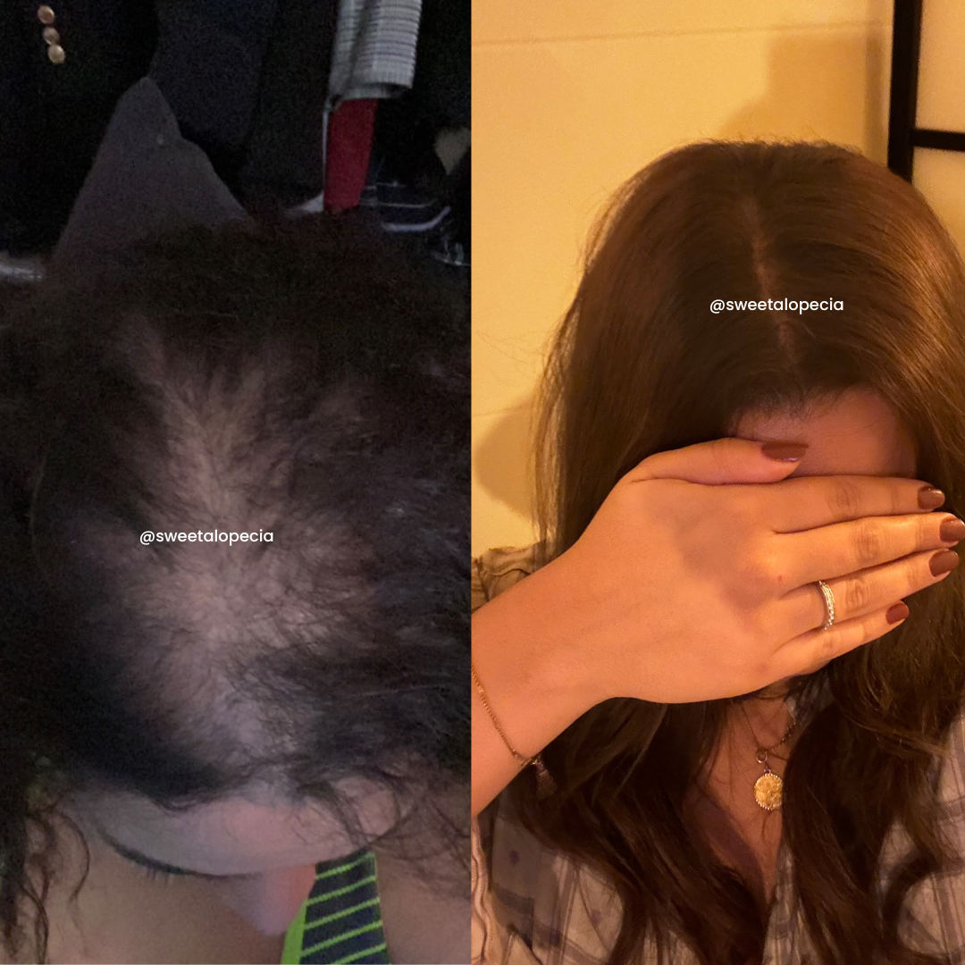 Le Duo Synergie - 2 mois de cure